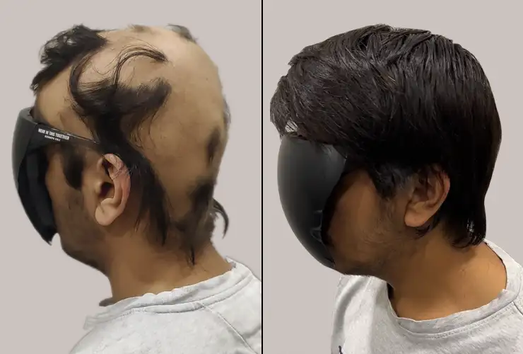 Human Hair Wigs